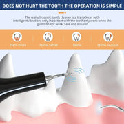 Pet Teeth Cleaning Tools Dog Toothbrushes Dog Supplies Pet Grooming Toothbrush Dental Stain Cleaning Pen Professional Products - My Store