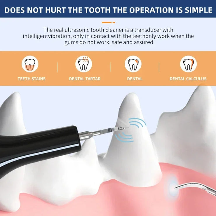 Pet Teeth Cleaning Tools Dog Toothbrushes Dog Supplies Pet Grooming Toothbrush Dental Stain Cleaning Pen Professional Products - My Store